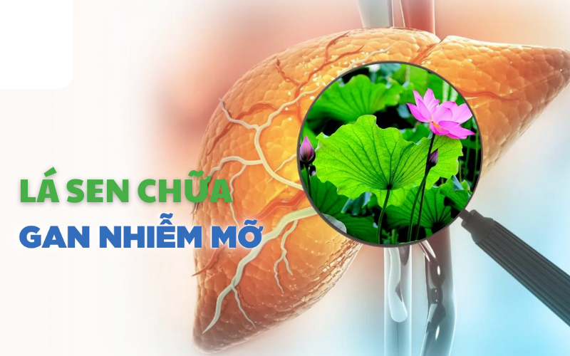 Lá sen chữa gan nhiễm mỡ